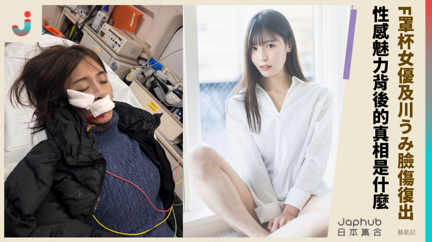 F罩杯女優及川うみ臉傷復出 性感魅力背後的真相是什麼