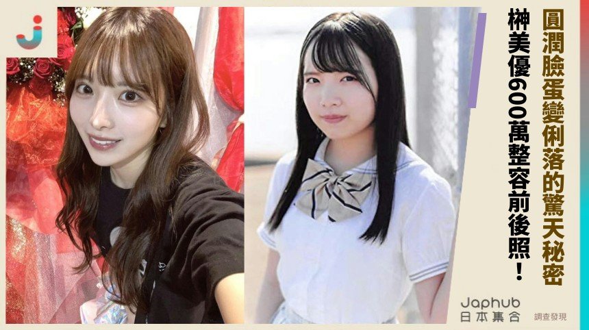 圓潤臉蛋變俐落的驚天秘密！ 榊美優600萬整容前後照！